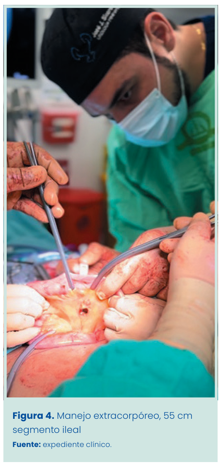 Figura 1. Grapadora lineal vascular aplicada en bloque al pedículo renal.