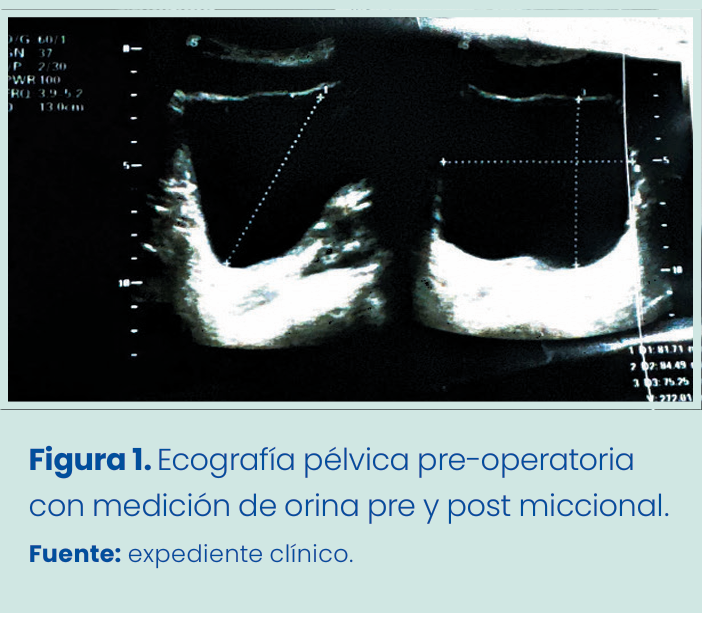 Figura 1. Grapadora lineal vascular aplicada en bloque al pedículo renal.