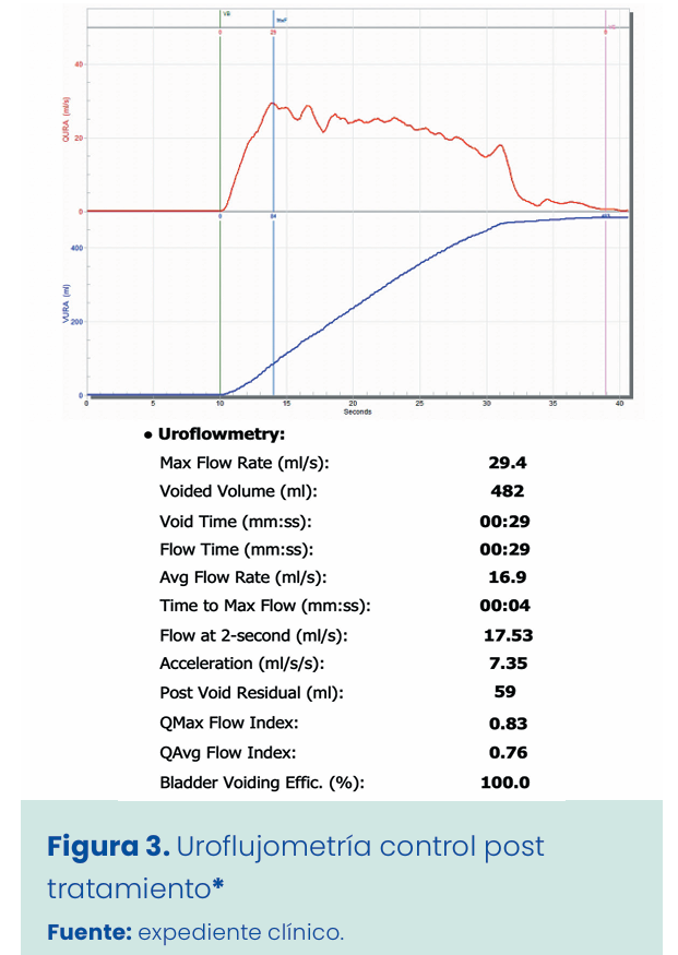 Figura 1. Grapadora lineal vascular aplicada en bloque al pedículo renal.